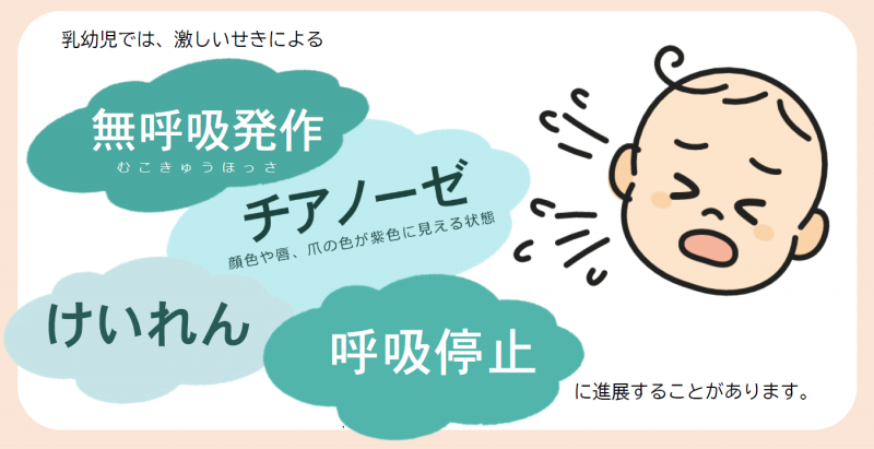 百日せき症状